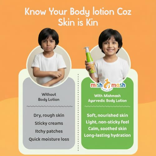 Mishmash Naturals Kids 2 in 1 Body Lotion and Cream for soft, hydrated skin | Ayurvedic Daily Moisturizer | All skin type | Made with Almond Oil, Saffron and Manjistha | For kids 3+ years | SLS & Paraben free | 200ml-Pack of 1